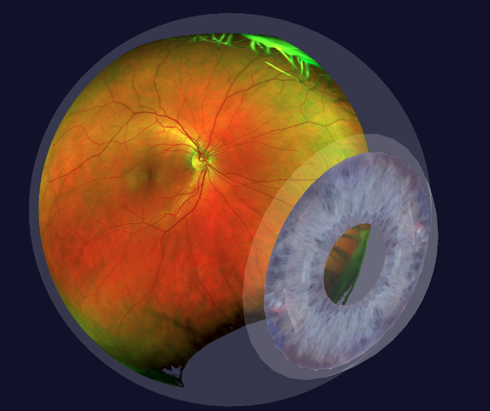 Digital Retina Imaging  Coconut Creek, FL 